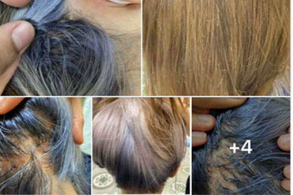 Tự tẩy tóc, cô gái nhận cái kết đắng-8