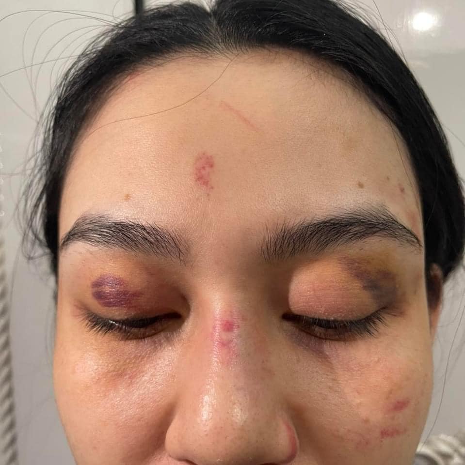 Người chị xã hội của Trần My bị đánh ở shop Trang Nemo lên tiếng: Em tin pháp luật sẽ lấy lại công bằng cho em-1