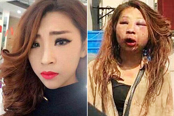 Tiểu tam rụng răng, thâm mắt, bay màu cả khuôn mặt hot girl vì dòm ngó chồng người khác-1