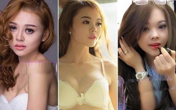 Ngoài Trang Nemo còn một số trường hợp chứng minh phẫu thuật thẩm mỹ để thay mặt đổi đời-1