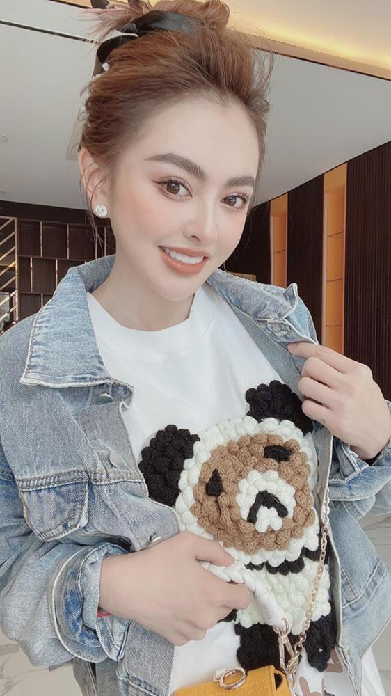 Ngoài Trang Nemo còn một số trường hợp chứng minh phẫu thuật thẩm mỹ để thay mặt đổi đời-2