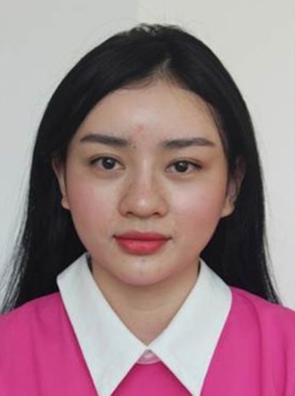 Ngoài Trang Nemo còn một số trường hợp chứng minh phẫu thuật thẩm mỹ để thay mặt đổi đời-5