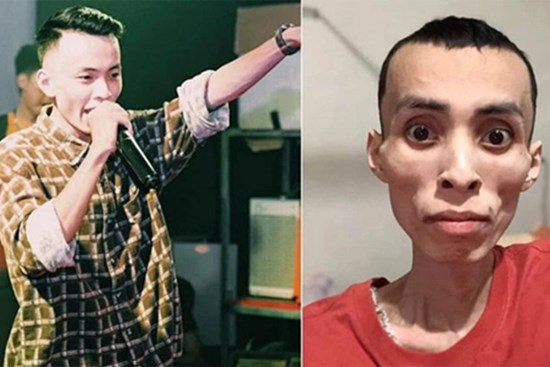 Nam rapper Việt qua đời vì bệnh ung thư ở tuổi 27: Cảnh báo loại ung thư nguy hiểm ai cũng có thể mắc, dấu hiệu bệnh dễ nhầm lẫn với 