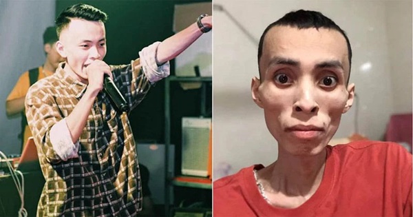 Nam rapper Việt qua đời vì bệnh ung thư ở tuổi 27: Cảnh báo loại ung thư nguy hiểm ai cũng có thể mắc, dấu hiệu bệnh dễ nhầm lẫn với bệnh vặt-1