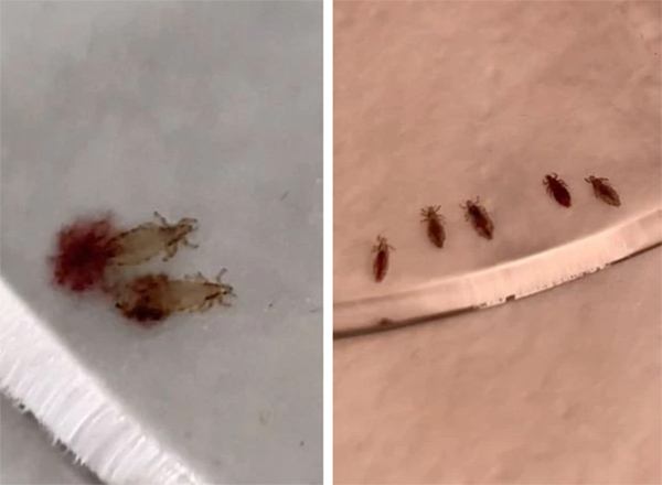 Bé gái mang quả đầu tổ quạ, chấy rận bò xuống cả tay để hút máu khiến chủ tiệm choáng váng lập tức gọi cơ quan bảo vệ trẻ em-2