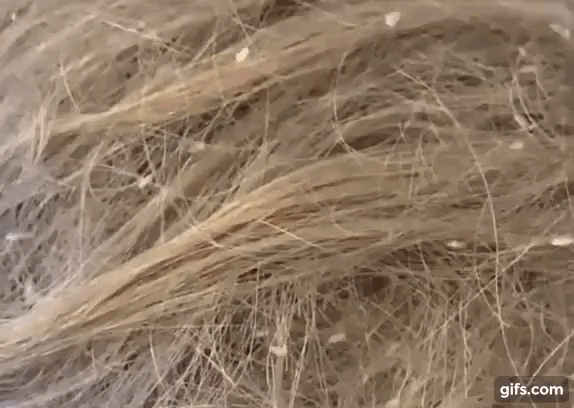 Bé gái mang quả đầu tổ quạ, chấy rận bò xuống cả tay để hút máu khiến chủ tiệm choáng váng lập tức gọi cơ quan bảo vệ trẻ em-1