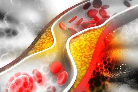 Mạch máu ảnh hưởng trực tiếp tuổi thọ, sau tuổi 40 rất dễ bị tắc nghẽn mạch máu, có 3