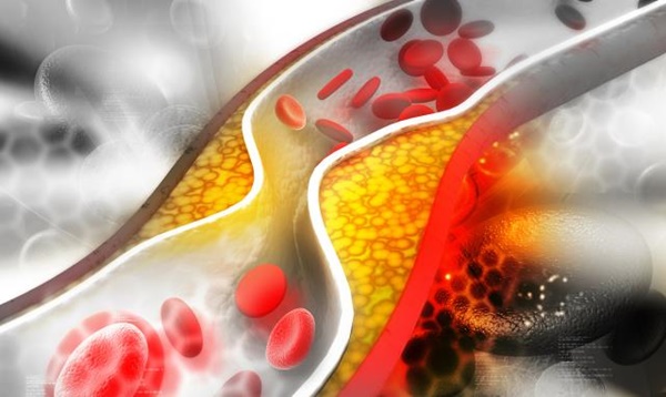 Mạch máu ảnh hưởng trực tiếp tuổi thọ, sau tuổi 40 rất dễ bị tắc nghẽn mạch máu, có 3 bảo bối này sẽ giúp thông mạch, ngừa lão hóa-1