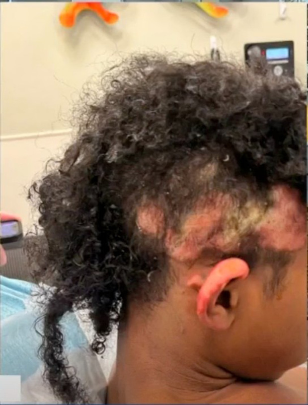 Đón con về từ trường học, mẹ đau đớn trước bộ dạng khủng khiếp của đứa trẻ, càng phẫn nộ hơn với thái độ của nhà trường trước vụ việc-1