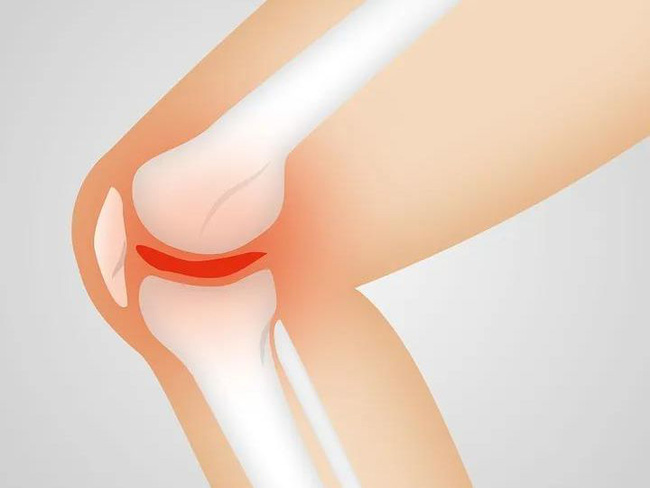 Đầu gối răng rắc, chân cứng ngắc, ngón tay khó gập... cảnh báo 5 bộ phận đang bị tổn thương, bỏ ngay 3 thói quen khiến bệnh nặng hơn-1