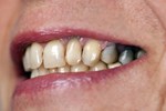 5 biểu hiện ở lưỡi cho thấy cơ thể đang có bệnh, nếu không có cái nào chứng tỏ bạn đang rất khỏe mạnh-4