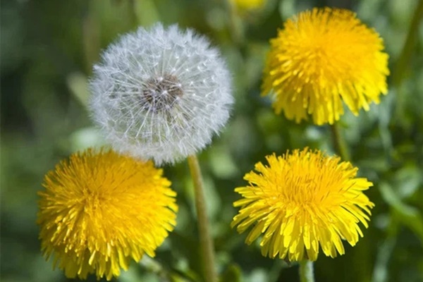 Người đàn ông 35 tuổi nôn ra máu, bất ngờ phát hiện ung thư dạ dày dù không thuốc lá, bia rượu, hóa ra chỉ vì 2 thói quen ăn uống người bận rộn hay làm-4