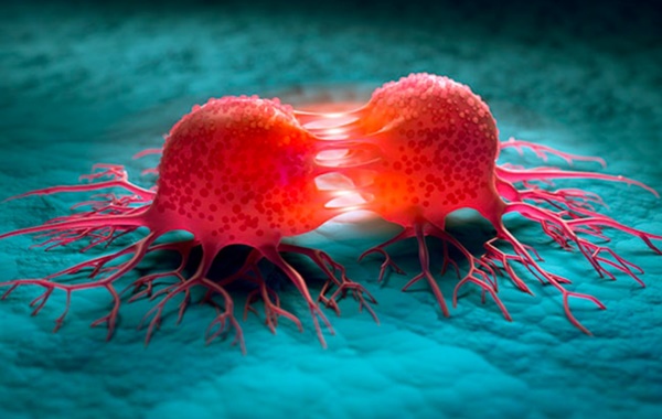 Những người sắp bị ung thư thường cảm thấy ĐAU ở 5 bộ phận trên cơ thể: Chỉ bị đau ở 1 điểm cũng cần phải đi khám khẩn cấp-1