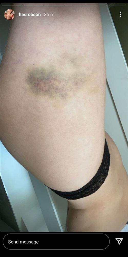 Sốc: Sao trẻ Greenwood (MU) bị tố đánh bạn gái hộc máu mồm-3