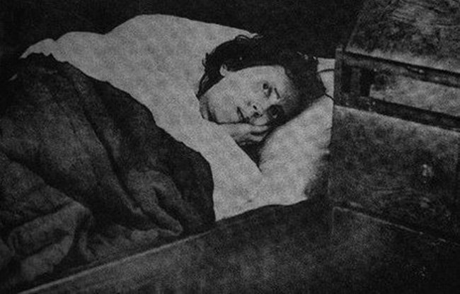 Người đẹp ngủ trong rừng đời thực: 32 năm ngủ say như chết, tỉnh dậy vẫn là thiếu nữ xinh đẹp, trở thành dấu hỏi lớn của y học thế giới-2