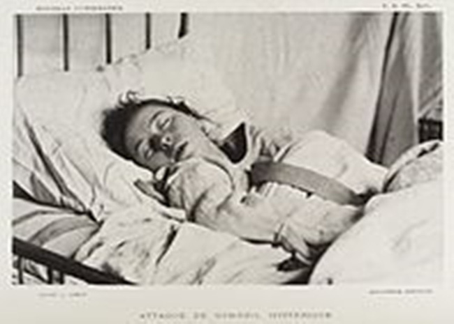 Người đẹp ngủ trong rừng đời thực: 32 năm ngủ say như chết, tỉnh dậy vẫn là thiếu nữ xinh đẹp, trở thành dấu hỏi lớn của y học thế giới-3