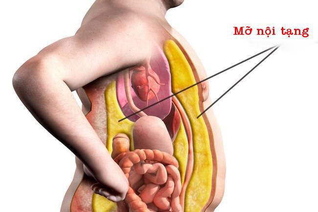 Cách xác định và đo lường mỡ nội tạng