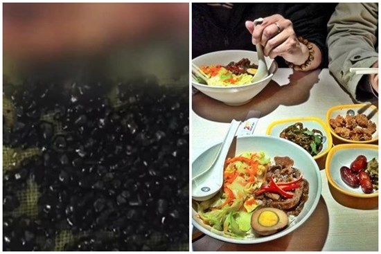 485 viên sỏi được lấy ra khỏi túi mật của chàng trai 28 tuổi sau khi bị đau bụng, nôn mửa, nguyên nhân đến từ 2 thói quen mà hầu hết người trẻ mắc phải