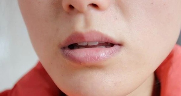 4 hiện tượng xuất hiện ở vùng miệng cho thấy gan đang có vấn đề, đừng chủ quan kẻo hối hận không kịp-2