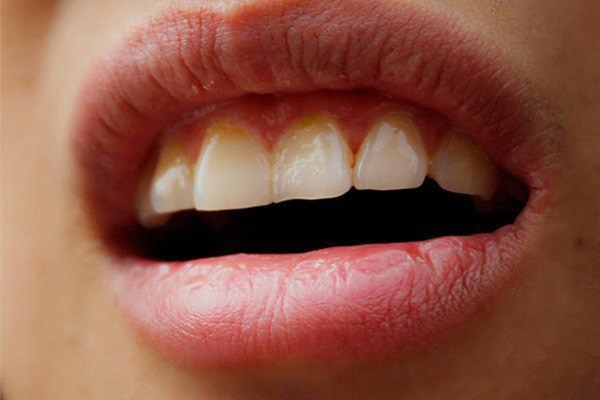 5 triệu chứng xuất hiện khi ngủ ngầm cảnh báo gan của bạn đang phát hỏa, xem thử bạn có điều nào hay không-1