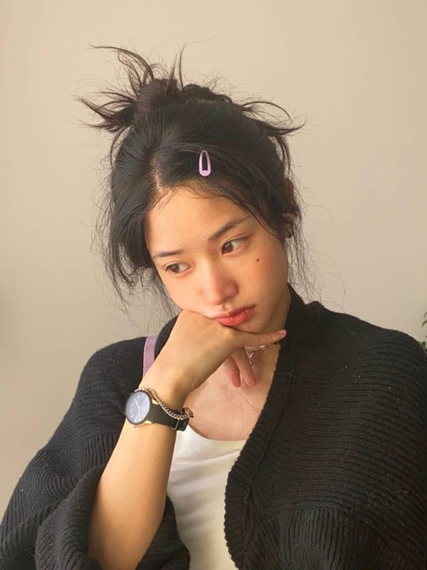 Người phụ nữ chủ quan với nốt ruồi ở lòng bàn chân rồi phải phẫu thuật đoạn chi vì ung thư, bác sĩ dạy 5 cách để phân biệt-3