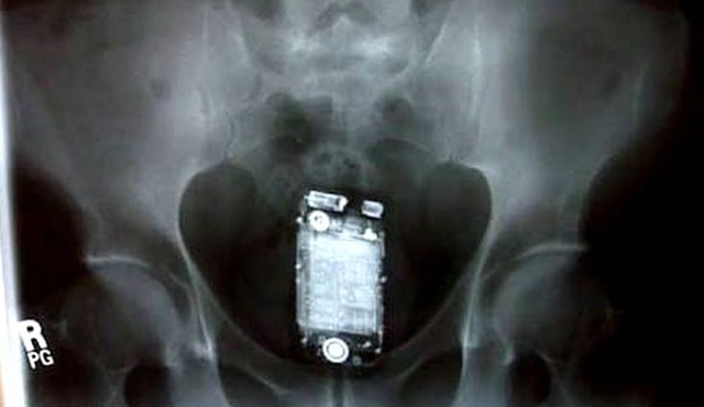 Cận cảnh chiếc điện thoại nhỏ xíu chuyên để... nhét hậu môn, nghe mục đích thâm sâu phía sau mà choáng-3