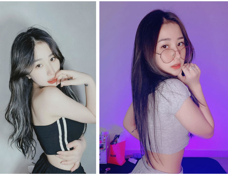 Một bộ phận trên mặt bỗng sưng phồng khiến Tiểu Hý vướng nghi vấn trùng tu nhan sắc-3