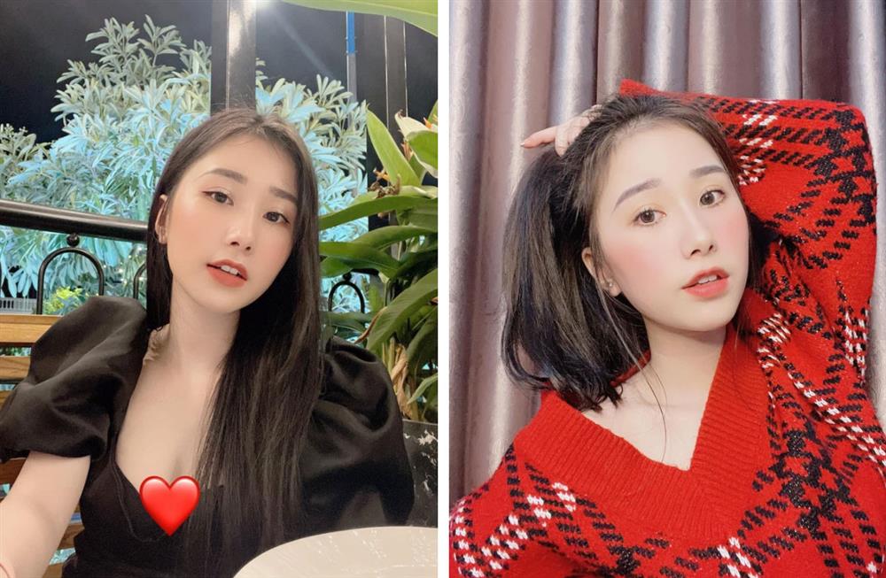 Một bộ phận trên mặt bỗng sưng phồng khiến Tiểu Hý vướng nghi vấn trùng tu nhan sắc-4