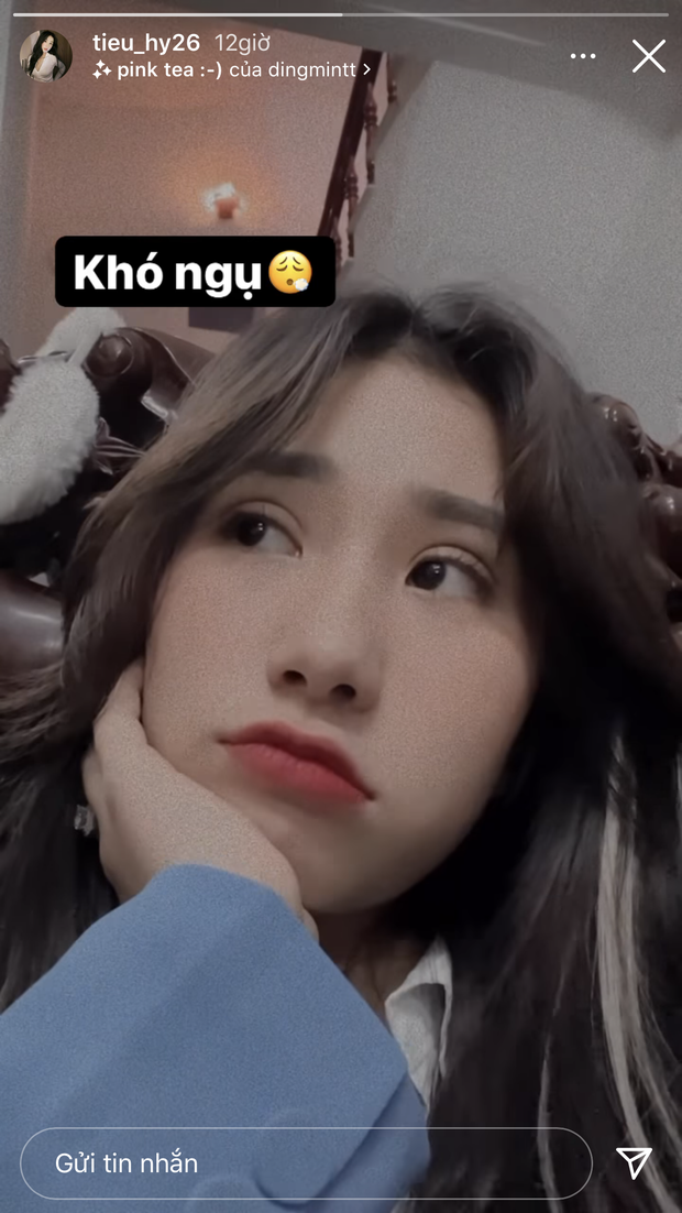 Một bộ phận trên mặt bỗng sưng phồng khiến Tiểu Hý vướng nghi vấn trùng tu nhan sắc-1