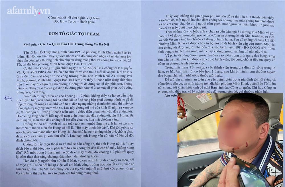 Cặp vợ chồng bị nhóm thanh niên cùng làng hành hung giữa đường, người vợ có nguy cơ sảy thai-1