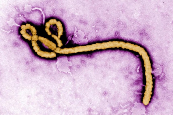 Phát hiện mới về loại virus khiến 25-90% người nhiễm bệnh tử vong-1