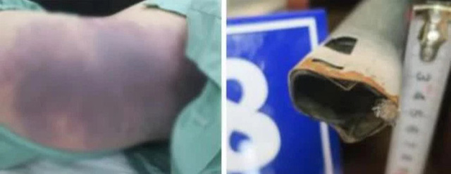 Vụ bé 8 tuổi bị mẹ kế bạo hành ở TP.HCM: Công bố kết luận giám định nguyên nhân tử vong-2