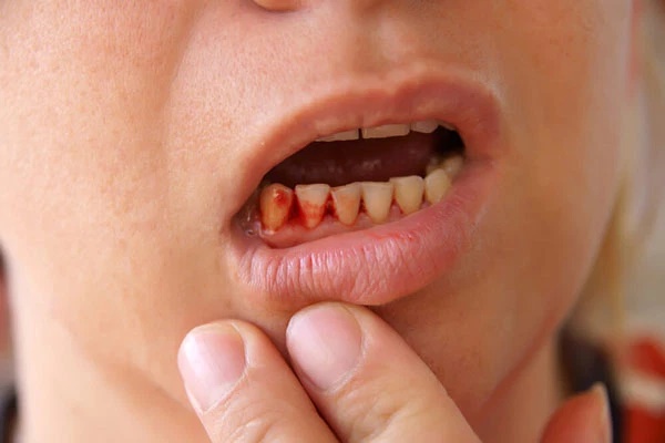 Đêm nào ngủ cũng thấy 3 tín hiệu chứng tỏ tế bào ung thư gan đã xuất hiện, bữa sáng là thời điểm vàng để bồi bổ gan vì thế cần ăn nhiều 3 món-5