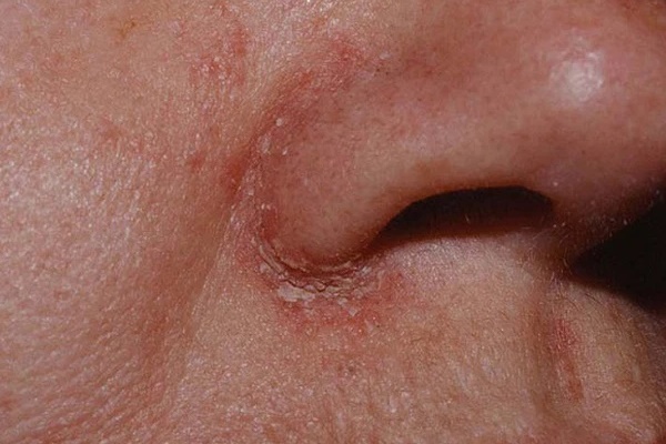 Người có phổi xấu thường có 3 triệu chứng, nếu bạn không bị cái nào thì bộ thở vẫn còn khỏe chán-2