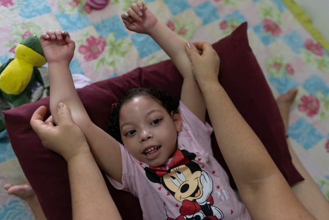 Bi kịch của những đứa trẻ mắc tật đầu nhỏ do Zika: Được các nhà khoa học săn đón để nghiên cứu, cuối cùng bị bỏ rơi không thương tiếc-2