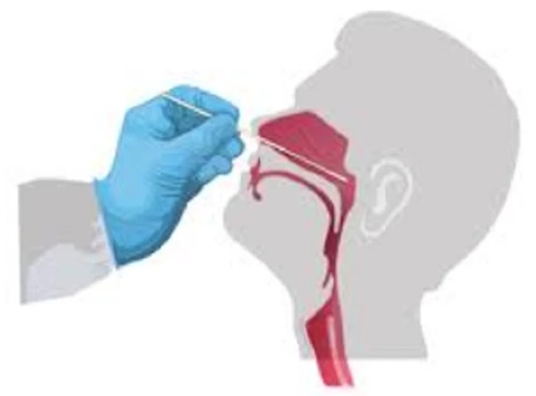 Test Covid nhanh hiện 2 vạch nhưng xét nghiệm PCR lại âm tính: BS chỉ rõ 3 lý do, lưu ý một điều sống còn dù đã, đang dương tính hay chưa bao giờ bị Covid-19-2