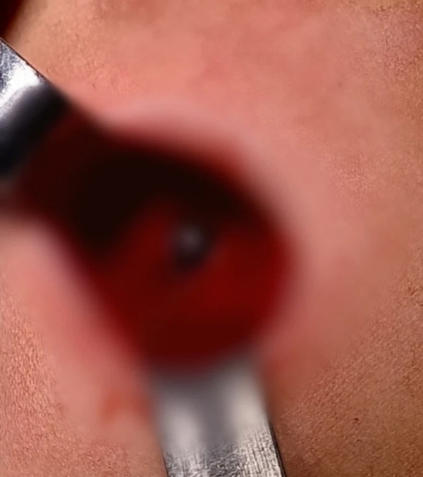 Anh trai 5 tuổi nghịch súng tự chế khiến em 4 tuổi trúng đạn nguy kịch-1