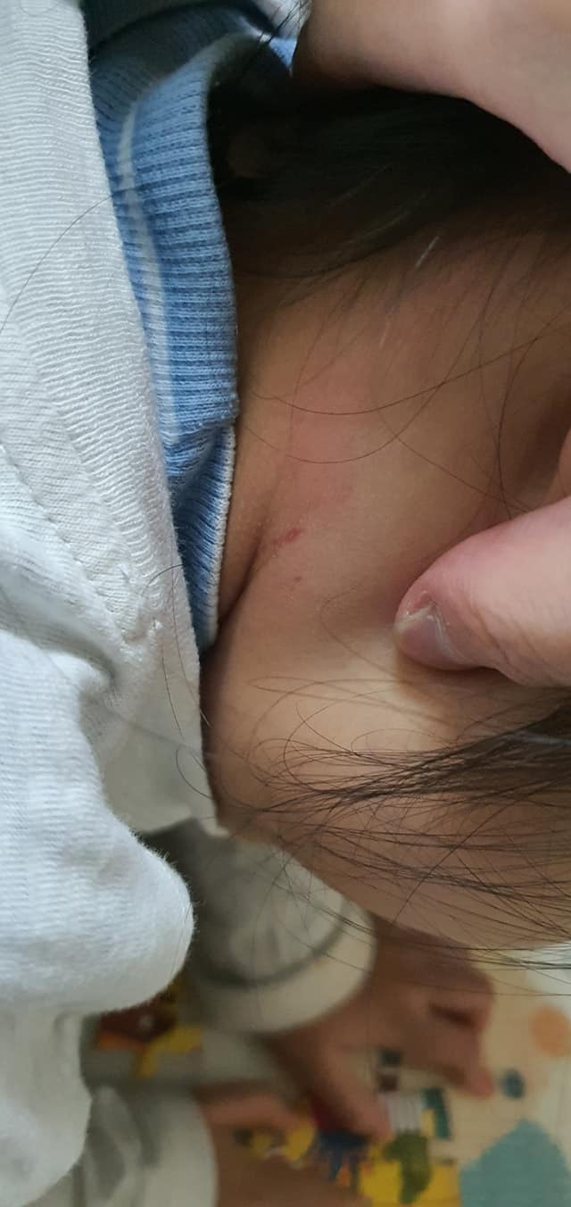 Bé gái bị cửa cuốn kẹp cổ khi ngồi tại quán trà ở Hà Nội, lời cảnh báo cho các phụ huynh-2