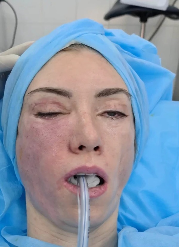 Nữ hoàng sắc đẹp chi hàng đống tiền phẫu thuật thẩm mỹ nào ngờ nhận cái kết ma chê quỷ hờn, xem hình trước khi làm đẹp mà xót xa-2