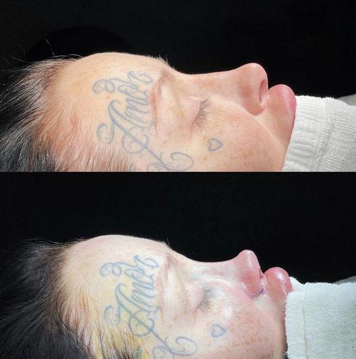 Chi hơn 2 tỷ phẫu thuật thẩm mỹ, 9X nhận cái kết đắng-3