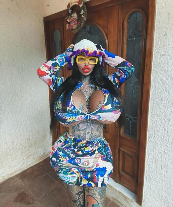 Chi hơn 2 tỷ phẫu thuật thẩm mỹ, 9X nhận cái kết đắng-5