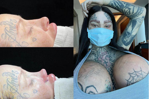 Người phụ nữ vào viện với 30 lỗ thủng trên người-3