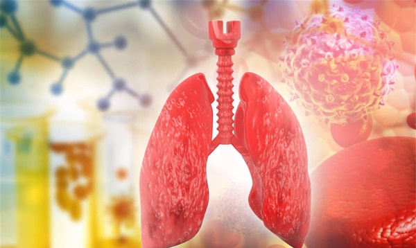 3 dấu hiệu bất thường vào buổi sáng chứng tỏ ung thư phổi đã xuất hiện, khuyến cáo 5 món ăn để giải độc phổi-1
