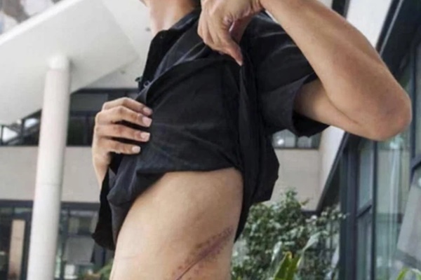 Nam sinh bán thận đổi lấy 80 triệu mua iPhone cho bạn gái: Cái kết cay đắng và cuộc sống thay đổi hoàn toàn sau 10 năm-1