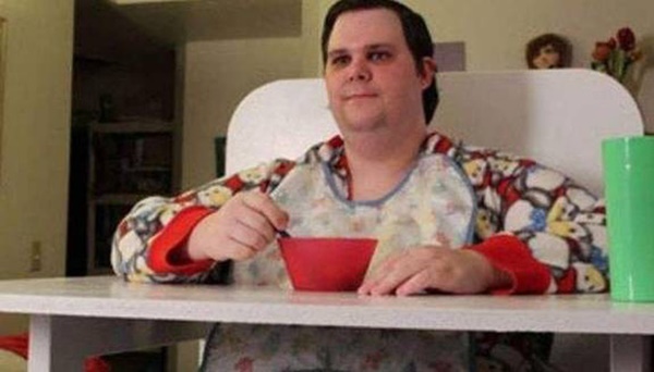 Bi kịch đứa trẻ khổng lồ: 33 tuổi vẫn mặc tã, dùng núm vú giả, cuộc sống khi trưởng thành quá đau lòng-1