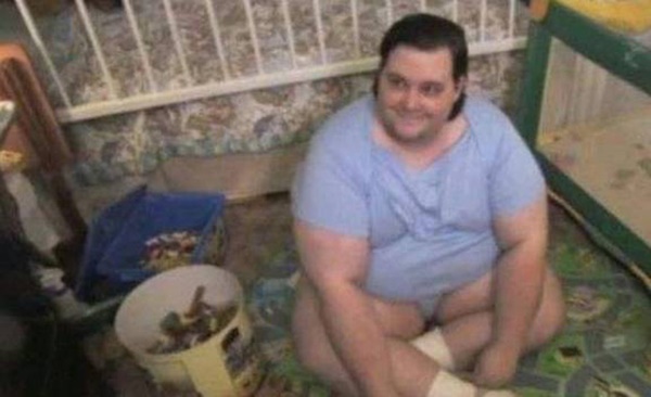 Bi kịch đứa trẻ khổng lồ: 33 tuổi vẫn mặc tã, dùng núm vú giả, cuộc sống khi trưởng thành quá đau lòng-5