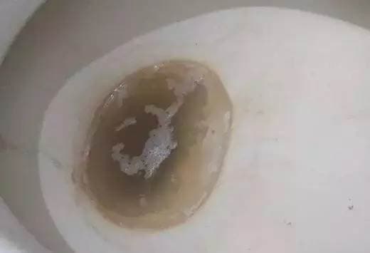 Rắc một nắm này vào bồn cầu, dù vết ố vàng bẩn hay cáu dày đến đâu thì sau khi xả nước cũng sẽ sạch bong-1