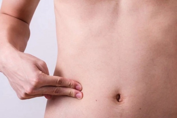 3 điểm bất thường ở bụng có thể liên quan đến bệnh ung thư, mong rằng bạn không có điều nào-3