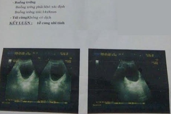 Tử cung phụ nữ rất cần được làm sạch bằng 5 món này, nên ăn nhiều để điều hòa nội tiết tố và tử cung luôn khỏe-7