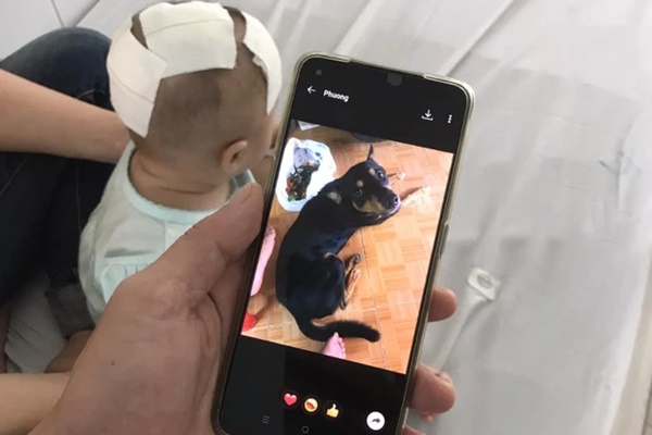 Nắm đuôi chú chó cưng trong nhà, bé gái 6 tháng tuổi đang tập bò bị cắn xuyên vào sọ-1